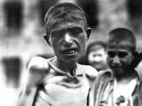 Голодающий ребенок в ГУЛАГе. Архивное фото с сайта www.gulag.ipvnews.org