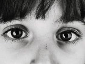 Глаза погибшего ребенка. Фото: pravportal.ru