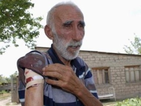 Раненый житель Южной Осетии.  Фото с сайта yahoo.com